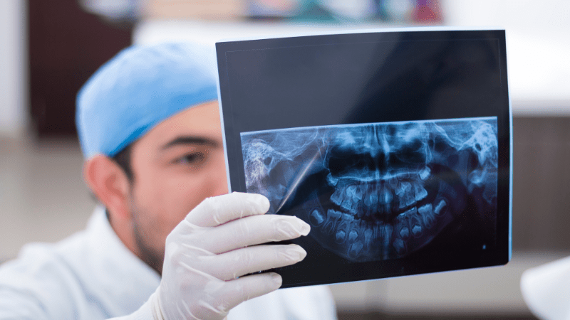 $50000 a Year Is How Much an Hour? 6 xray min 1
